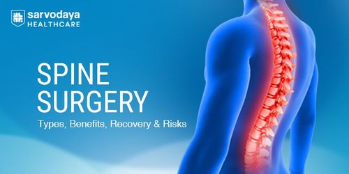 Spine Surgery - Types, Benefits, Recovery & Risks