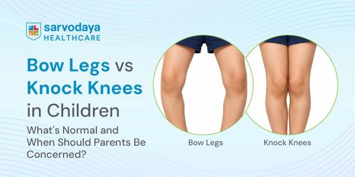 Bow Legs vs Knock Knees in Children: What's Normal and When Should Parents Be Concerned?