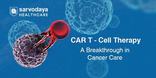 CAR T-cell Therapy: A Breakthrough in Cancer Care