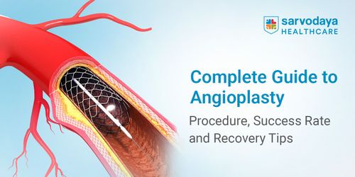 Complete Guide to Angioplasty: Procedure, Success Rate and Recovery Tips
