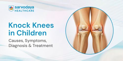 Knock Knees in Children: Causes, Symptoms, Diagnosis & Treatment