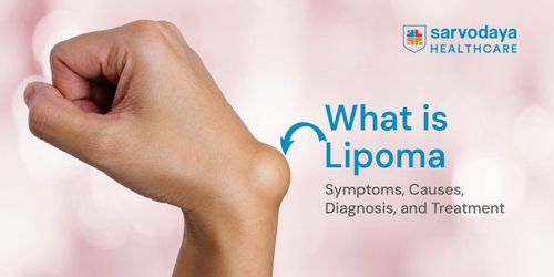 What is Lipoma? Symptoms, Causes, Diagnosis, and Treatment