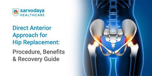 Direct Anterior Approach for Hip Replacement: Procedure, Benefits & Recovery