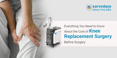 Everything You Need to Know About the Cost of Knee Replacement Surgery Before Surgery