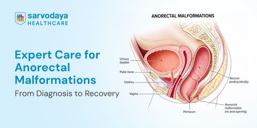 Expert Care for Anorectal Malformations: From Diagnosis to Recovery