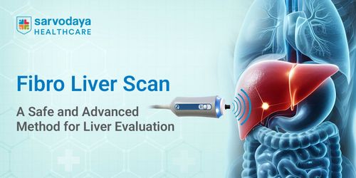 Fibro Liver Scan: A Safe and Advanced Method for Liver Evaluation