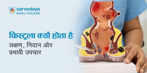 फिस्टुला क्यों होता है: लक्षण, निदान और प्रभावी