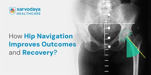 How Hip Navigation Improves Outcomes and Recovery