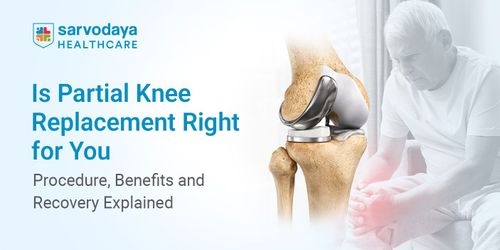 Is Partial Knee Replacement Right for You? Procedure, Benefits and Recovery Explained