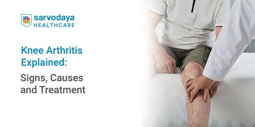 Knee Arthritis Explained: Signs, Causes and Treatment