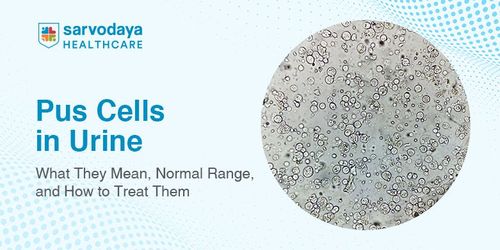 Pus Cells in Urine: What They Mean, Normal Range, and How to Treat Them