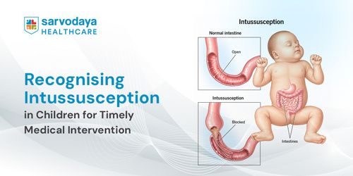 Recognising Intussusception in Children for Timely Medical Intervention