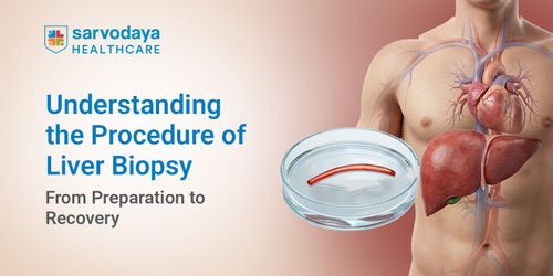 Understanding the Procedure of Liver Biopsy: From Preparation to Recovery