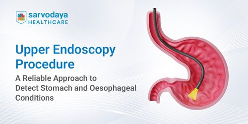 Upper Endoscopy Procedure: A Reliable Approach to Detect Stomach and Oesophageal Conditions