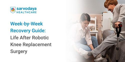 Week-by-Week Recovery Guide: Life After Robotic Knee Replacement Surgery