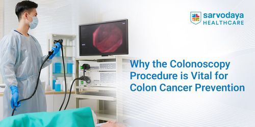Why the Colonoscopy Procedure Is Vital for Colon Cancer Prevention