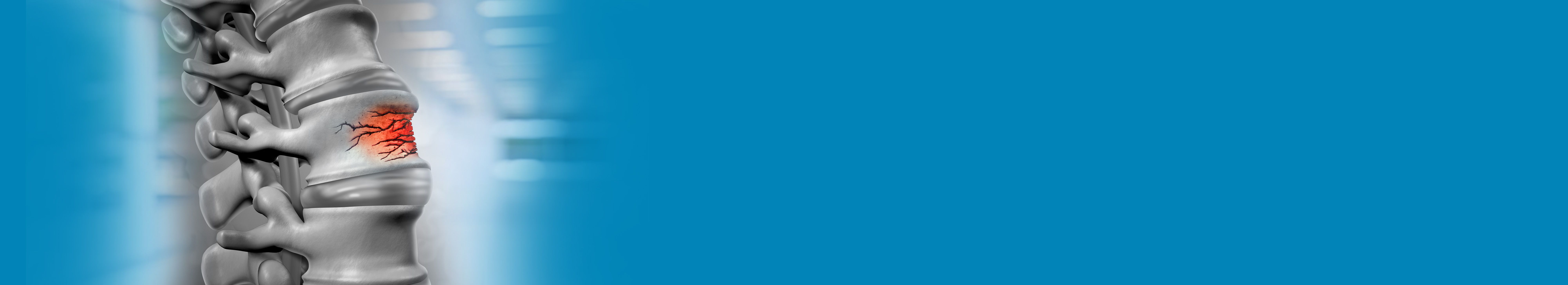 Best Spinal Trauma Management Hospital