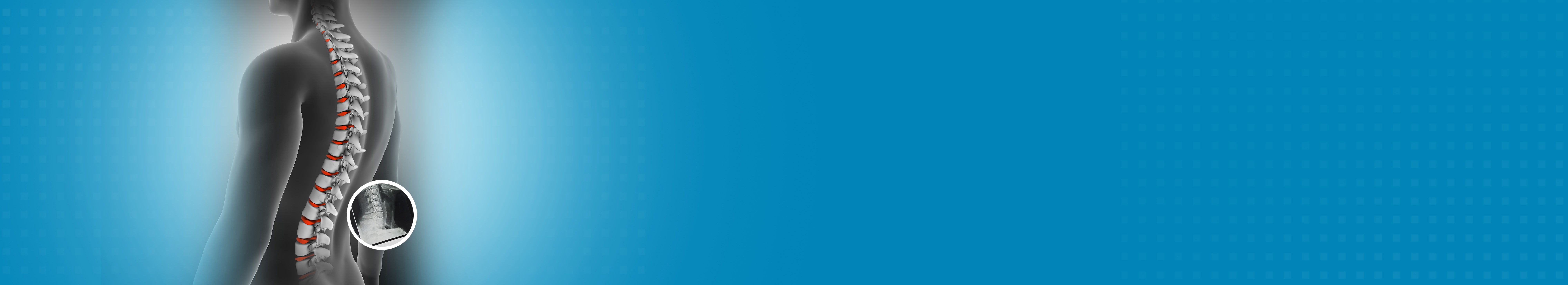Best Hospital for Spinal Fracture Treatment