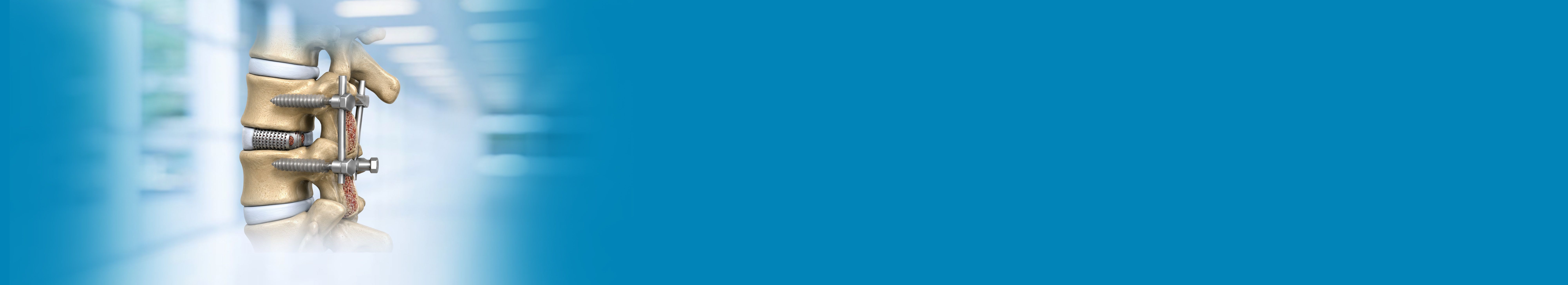 Best TLIF Surgery Hospital